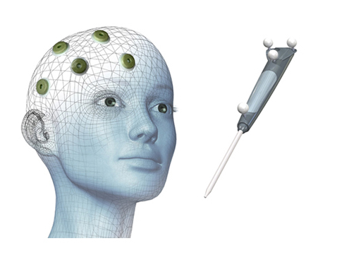 ILUMARK Multi Modality Marker